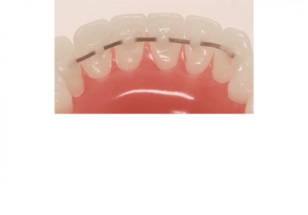 �������� ������� 010�.029 (15��) AO CO-AX 856-SL-1029,American Orthodontics