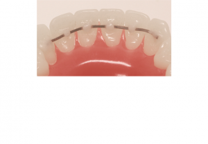 �������� ������� 010�.029 (15��) AO CO-AX 856-SL-1029,American Orthodontics
