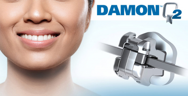 ����� �������� Damon Q2 ���� 0.22, 20 ��. Ormco (� ��������)