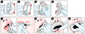 OptraGate 2 Regular �����������, ��.80��.,  Ivoclar