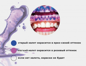 ��������� ������� ������, Plaque indication 